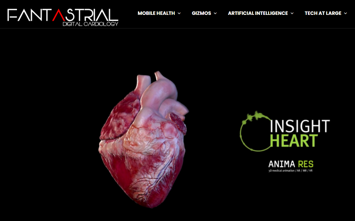 Image of landing page for Fantastrial digital cardiology